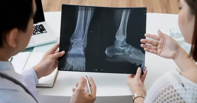 Cáncer de Huesos: tipos, síntomas, diagnóstico y tratamiento